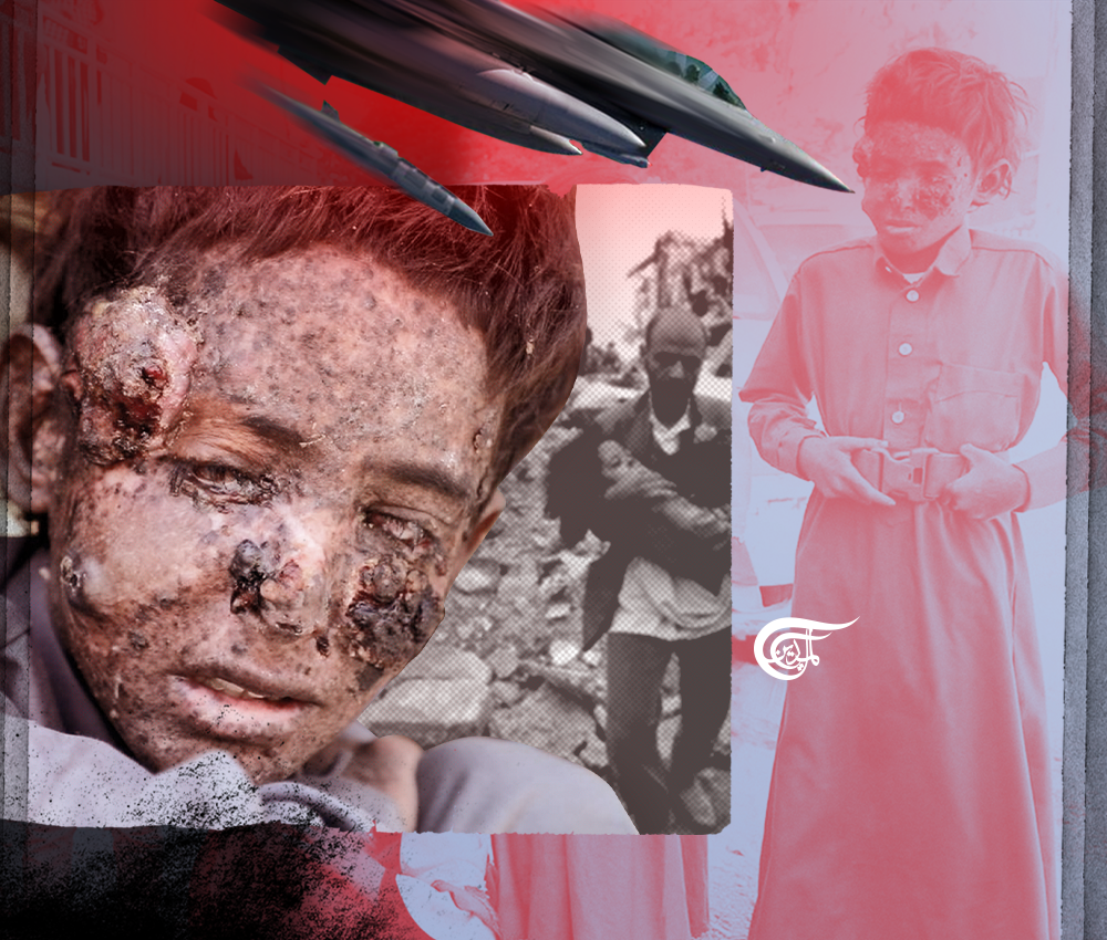 أطفال اليمن.. وسرطان الحرب العبثية