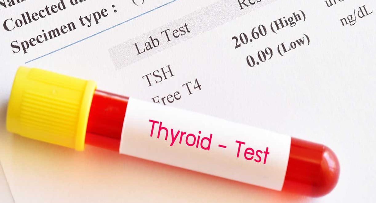 كيف تقرأ تحليل الغدة الدرقية 