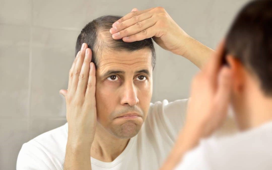 أسباب تساقط الشعر عند الرجال متعددة