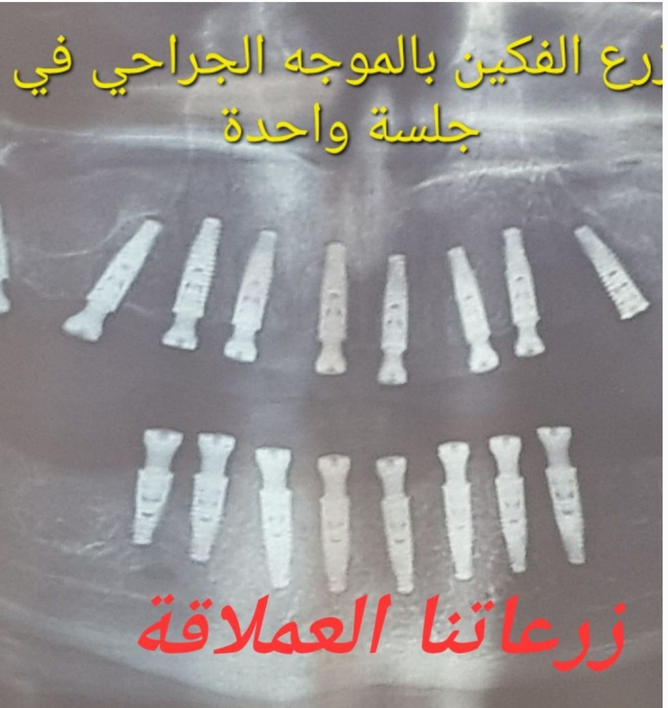 زرع بواسطة الموجه الحراري اللبناني الصنع