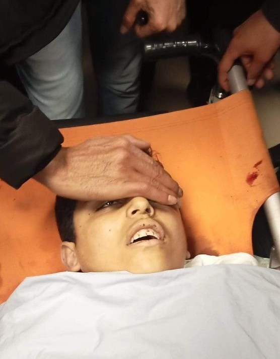 استشهاد فتى فلسطيني خــلال اقتحـــام قوات الاحتلال لمخيم جنين