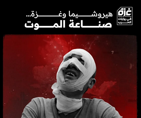 الحروق الحروق