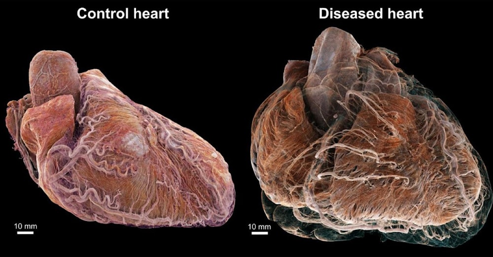 أول صورة ثلاثية الأبعاد لقلبين بشريين وصولاً إلى المستوى الخلوي