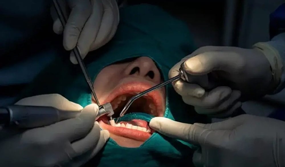 استخدام  تكنولوجيا النانو في طب الأسنان (الصورة: الوفاق الإيرانية)