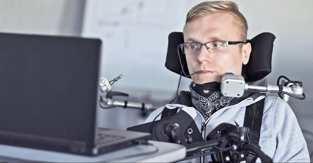 اكتشاف السبب المحتمل لمرض التصلب الجانبي الضموري