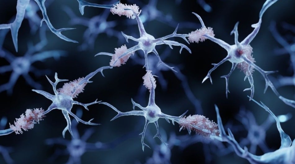 ثورة طبية.. اكتشاف مادة طبيعية في الجسم تكافح ألزهايمر
