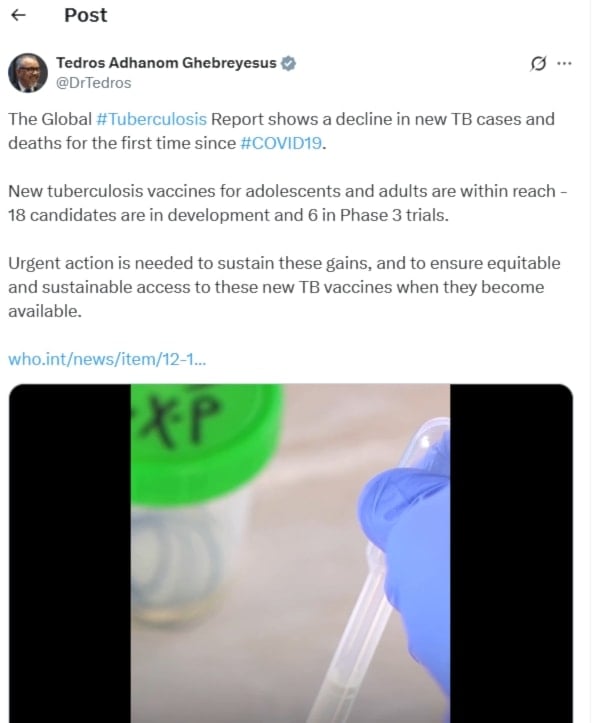 الأشد فتكاً في العالم.. وفاة أكثر من مليون شخص بسبب السل