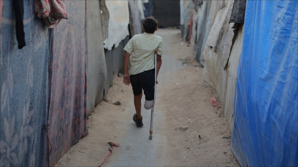 طفل فلسطيني يسير بين الخيم متكئاً على عكازه 11 تشرين الثاني/نوفمبر 2025 (الأناضول)