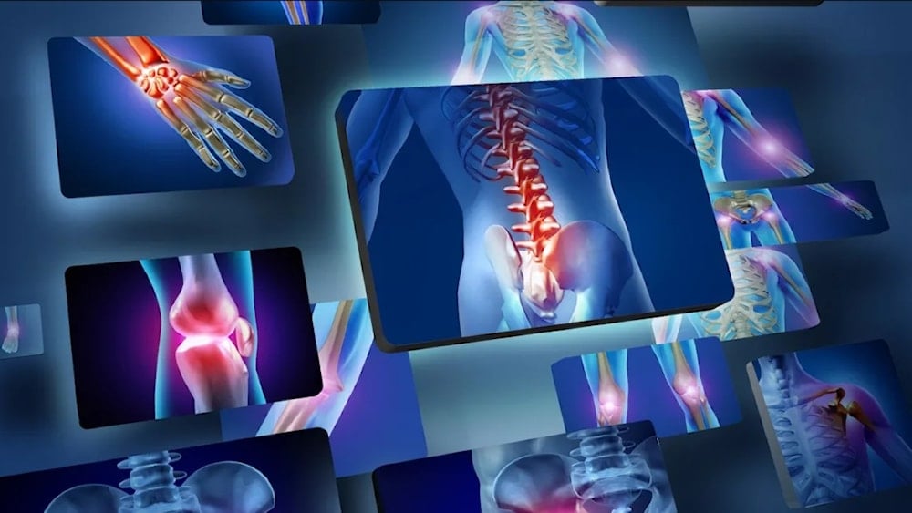 أطباء بريطانيون يستخدمون الذكاء الاصطناعي للعثور على الكسور وعلاجها