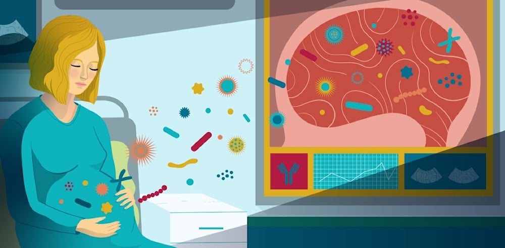 إصابة الحوامل بكورونا هل يعرض أطفالهن لخطر طيف التوحد؟.. دراسة تجيب!