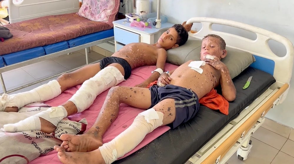 زين نور وجود الأنقر يتعافيان في مستشفى الشفاء بمدينة غزة بعد إصابتهما بعبوة غير المنفجرة