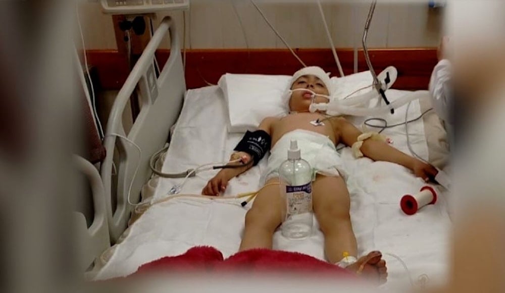 حليمة في مستشفى غزة في 21-2-2024 ترقد في غيبوبة بعد عملية جراحية كبرى