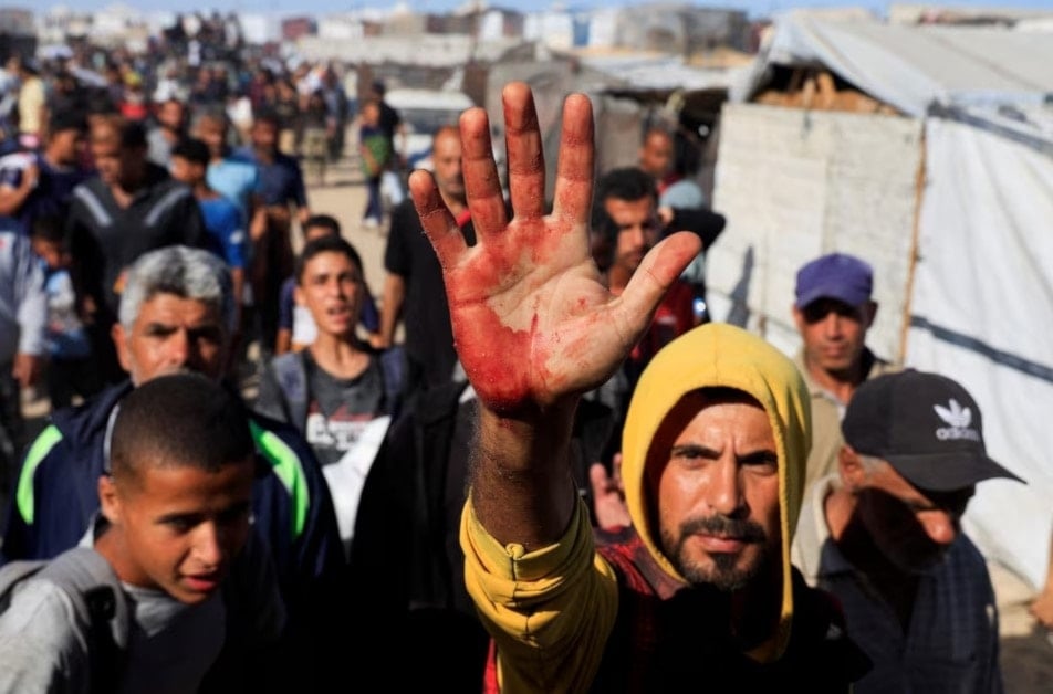 رجل فلسطيني يظهر بقع دماء على راحة يده، بعد استلامه إمدادات الإغاثة من 