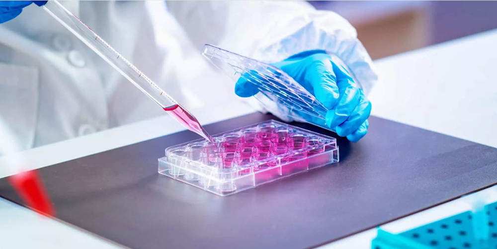 الاكتشاف سيسمح بزيادة فعالية العلاجات الجينية القائمة على CRISPR/Cas9 لعلاج أمراض الدم