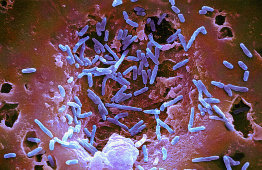 سلالة بكتيرية تُدعى Hominenteromicrobium YB328
