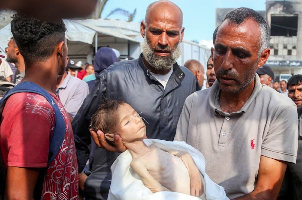 طفل ارتقى شهيداً بسبب المجاعة في غزة وسط استمرار حرب الإبادة الجماعية (AFP)