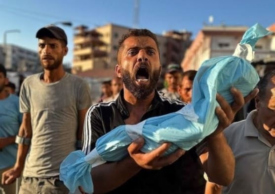 جثمان طفل رضيع توفي نتيجة سوء التغذية في قطاع غزة (أرشيف)
